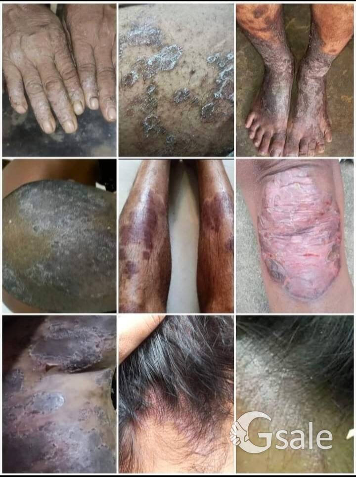 Skin Problems & Solution 