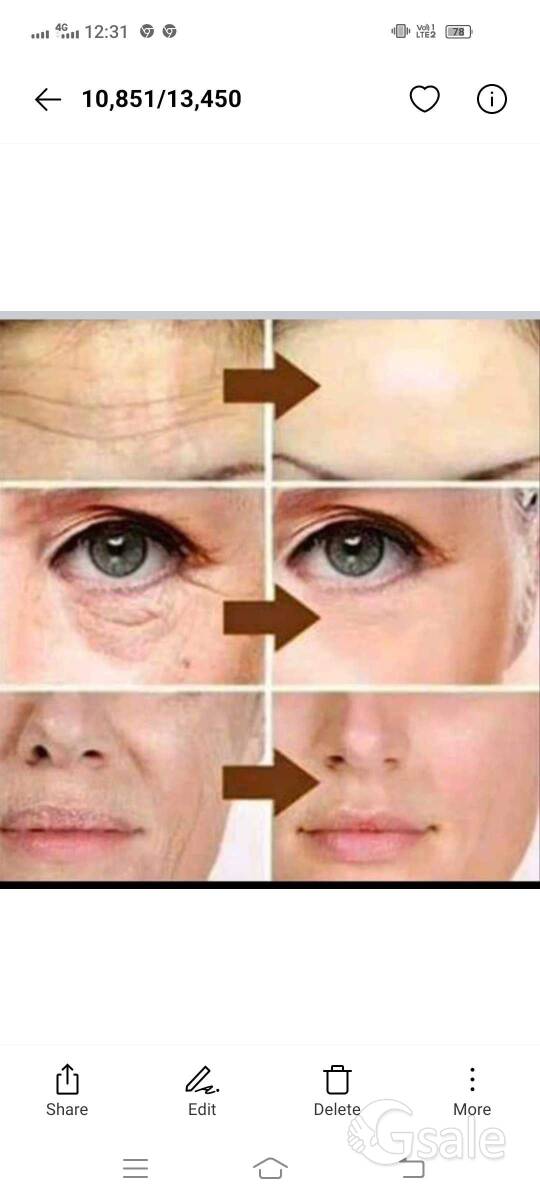 pigmentation cream